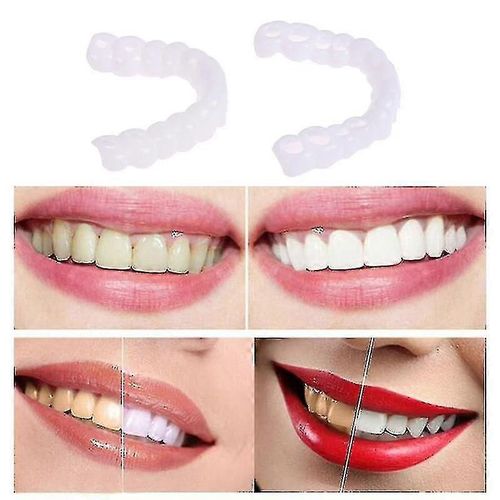Facettes Dentaires En Silicone Pour Prothèses Dentaires, 3 Paires, Pour Blanchiment Des Dents Blanc