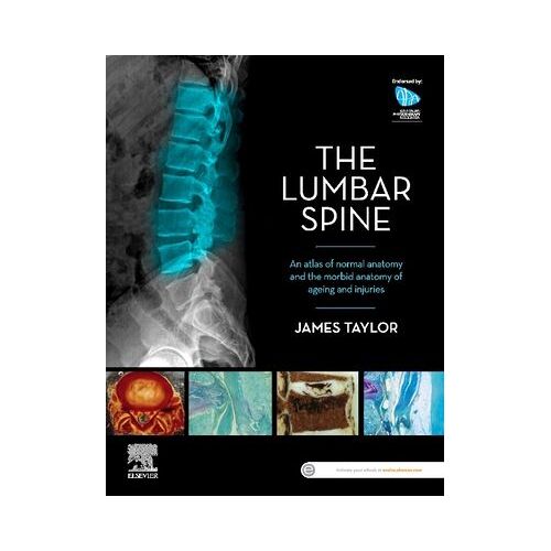 The Lumbar Spine