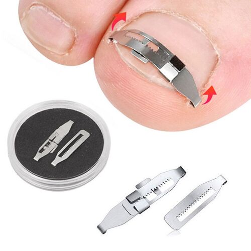 Outil Professionnel De Soin Des Ongles Incarnés, Traitement Des Ongles, Pédicure, Récupération De Gélatine, Parker 