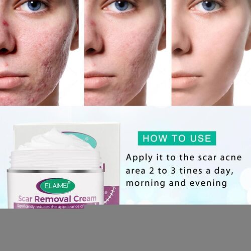 Enlever Les Cicatrices, Restaurer L'apparence De La Peau, Éliminer Les Coupures, Les Vergetures, Les Marques De Vergetures, Les Rouges, L'acné, Les Marques De Visage, Les Brûlures De La Peau, Le Gonfl 