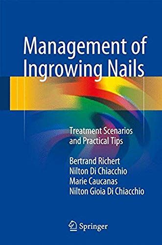 Management Of Ingrowing Nails