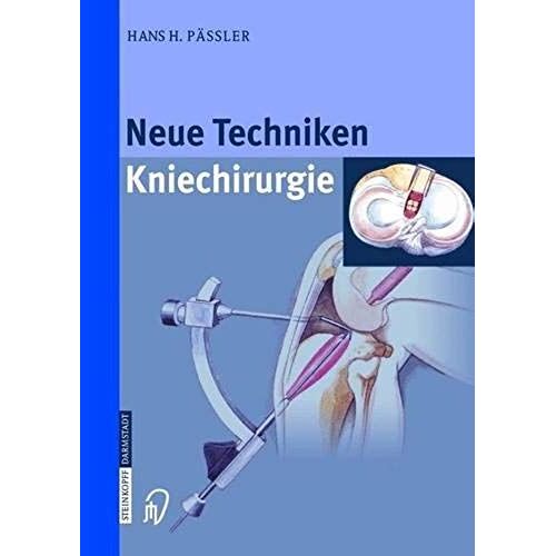 Neue Techniken - Kniechirurgie