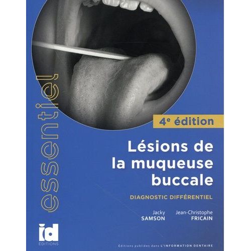 Lésions De La Muqueuse Buccale - Diagnostic Différentiel