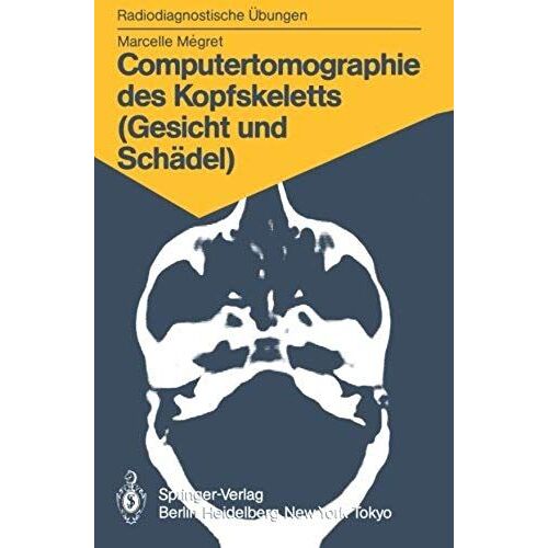 Computertomographie Des Kopfskeletts (Gesicht Und Schädel)