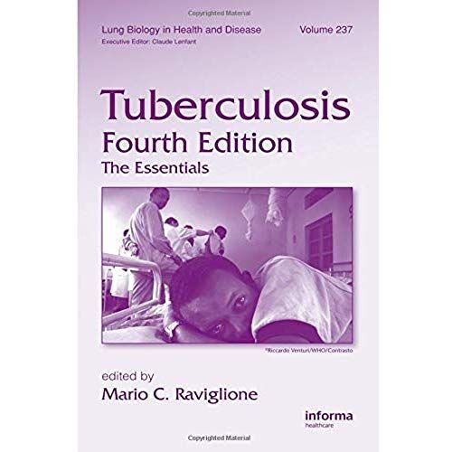 Tuberculosis