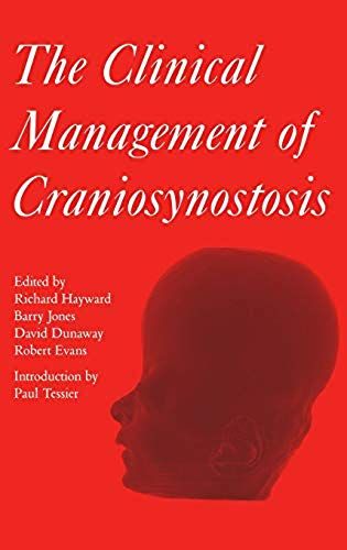 The Clinical Management Of Craniosynostosis