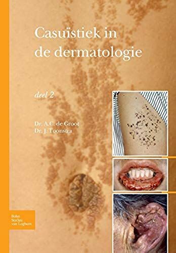 Casuïstiek In De Dermatologie - Deel 2
