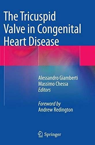 The Tricuspid Valve In Congenital Heart Disease
