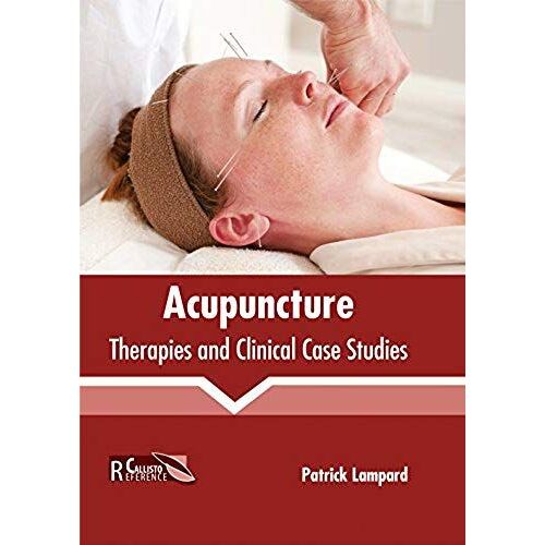 Acupuncture