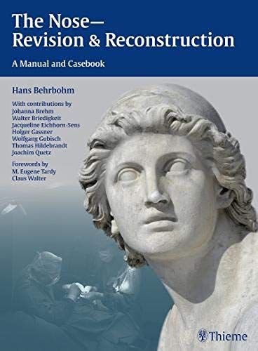 Revision Surgery Of The Nose - A Casebook For Problem-Solving In Rhinoplasty And Reconstructive Surgery