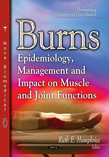Burns