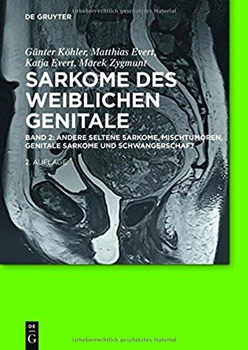 Sarkome Des Weiblichen Genitale 2