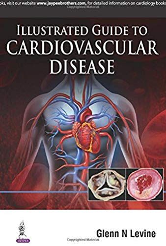 Illustrated Guide To Cardiovascular Disease