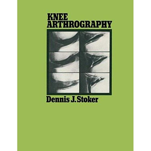 Knee Arthrography