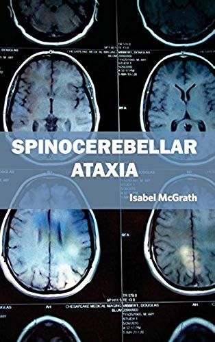 Spinocerebellar Ataxia