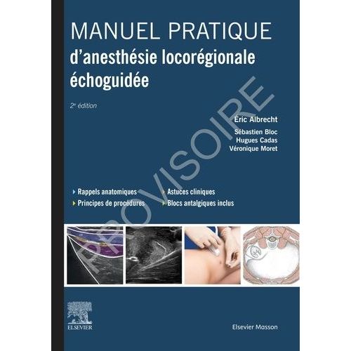 Manuel Pratique D'anesthésie Locorégionale Échoguidée