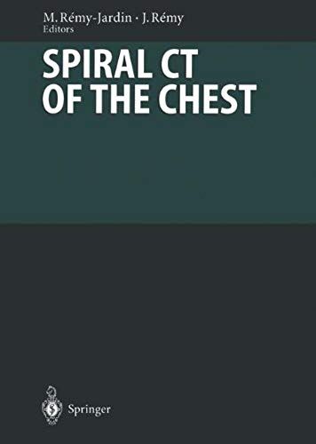Spiral Ct Of The Chest: With Contributions By Numerous Experts (Medical Radiology)