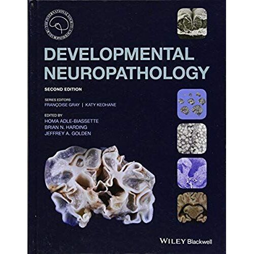 Developmental Neuropathology