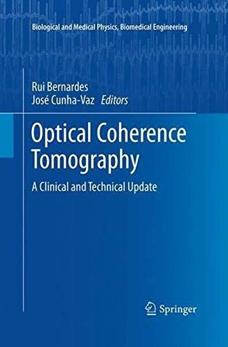 Optical Coherence Tomography