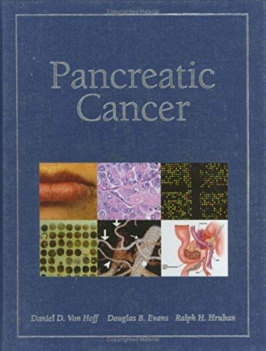 Pancreatic Cancer