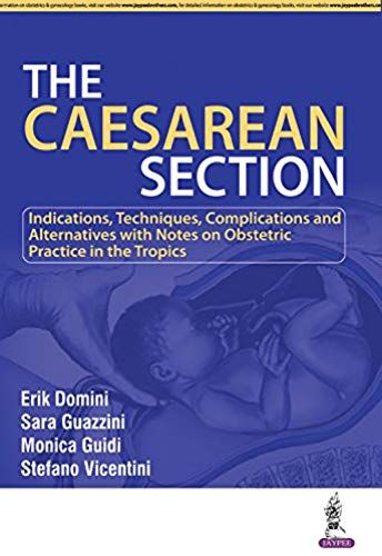 The Caesarean Section