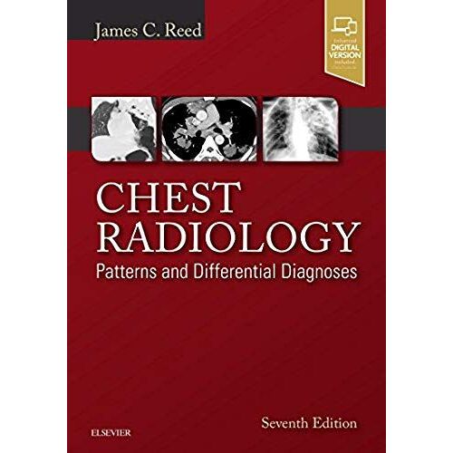 Chest Radiology