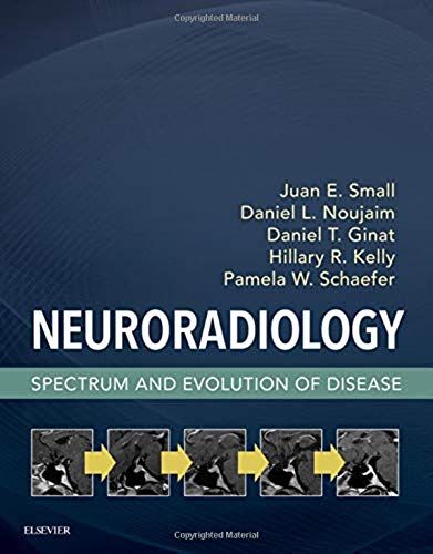 Neuroradiology: Spectrum And Evolution Of Disease