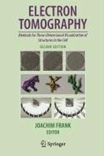 Radiation Exposure And Occupational Risks (Medical Radiology)