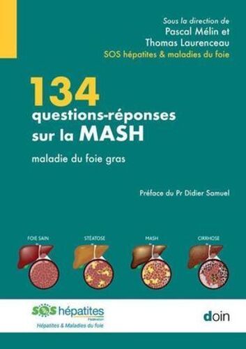 134 Questions-Réponses Sur La Mash