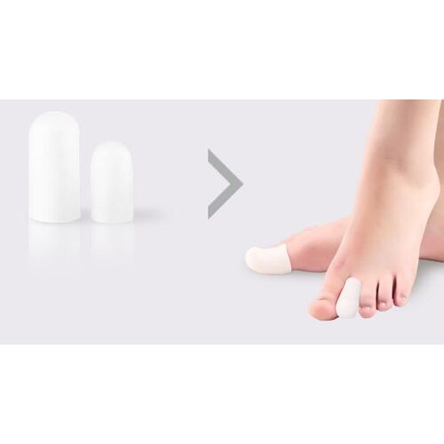 Séparateurs D'orteils, Tube De Gel De Silicone Pour Amortir Les Cors Et Callosités Pour Les Soins Des Pieds