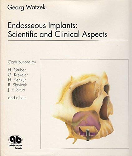 Endosseous Implants: Scientific And Clinical Aspects