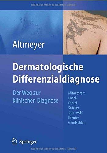 Dermatologische Differenzialdiagnose: Der Weg Zur Klinischen Diagnose (German Edition)