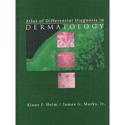 Atlas Of Differential Diagnosis In Dermatology, 1e