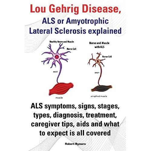 Lou Gehrig Disease, Als Or Amyotrophic Lateral Sclerosis Explained. Als Symptoms, Signs, Stages, Types, Diagnosis, Treatment, Caregiver Tips, Aids And