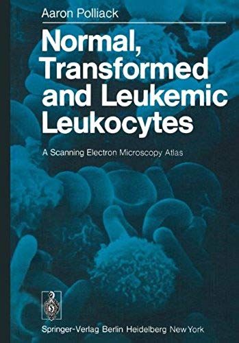 Normal, Transformed And Leukemic Leukocytes: A Scanning Electron Microscopy Atlas