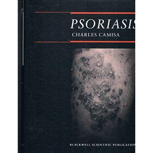 Psoriasis