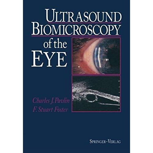 Ultrasound Biomicroscopy Of The Eye