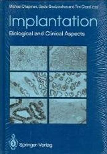 Implantation: Biological And Clinical Aspects
