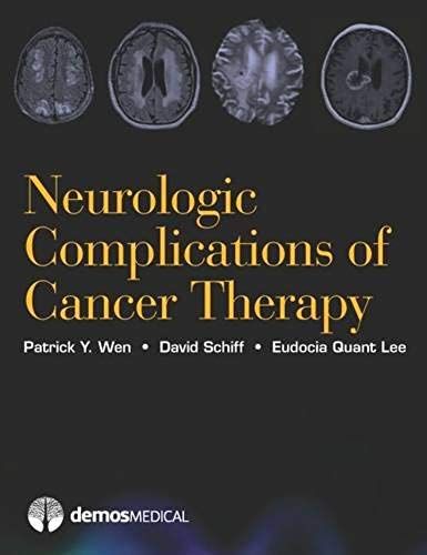 Neurologic Complications Of Cancer Therapy