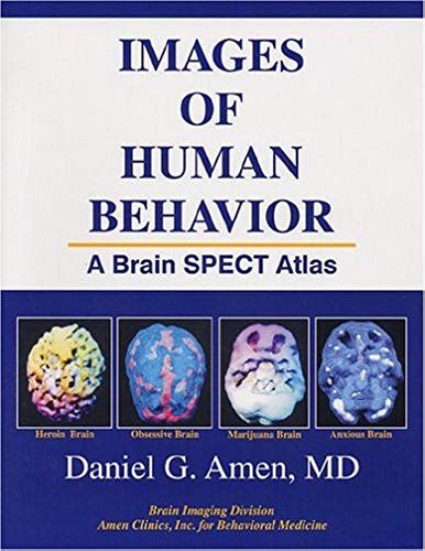 Images Of Human Behavior: A Brain Spect Atlas