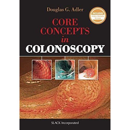 Core Concepts In Colonoscopy