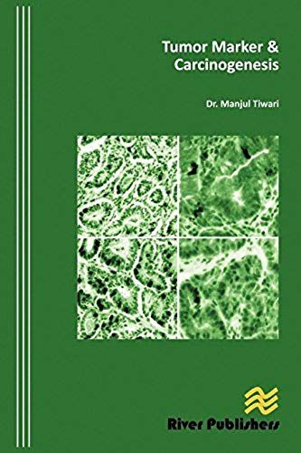 Tumor Marker And Carcinogenesis