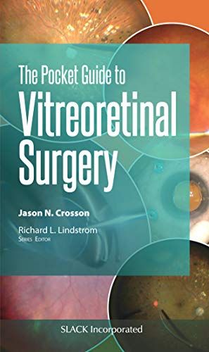 The Pocket Guide To Vitreoretinal Surgery