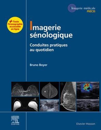 Imagerie Sénologique