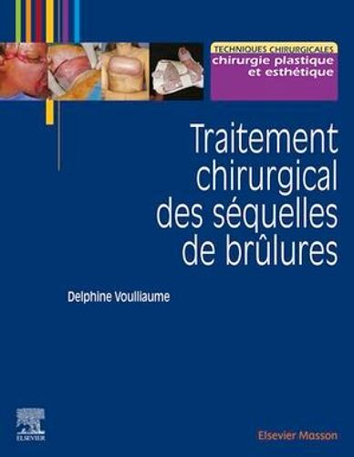 Traitement Chirurgical Des Séquelles De Brûlures
