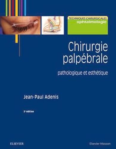 Chirurgie Palpébrale