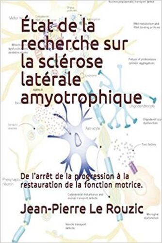 État De La Recherche Sur La Sclérose Latérale Amyotrophique
