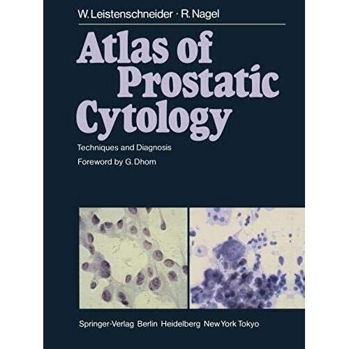 Atlas Of Prostatic Cytology