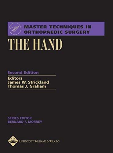The Hand