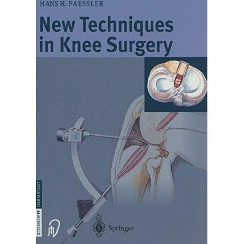 New Techniques In Knee Surgery